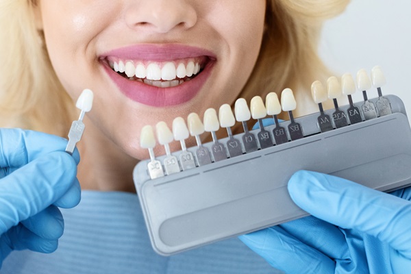 The Benefits Of Getting Dental Lumineers